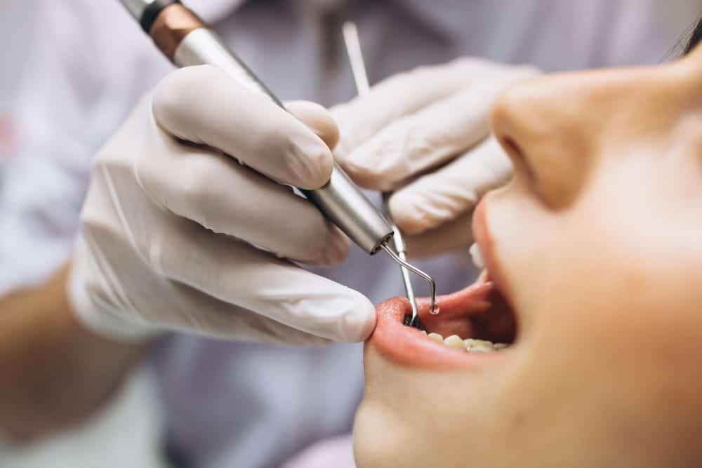 Dentist using a dental scaler to clean a patient’s teeth during a professional dental cleaning.