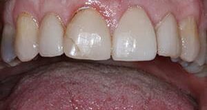 Before